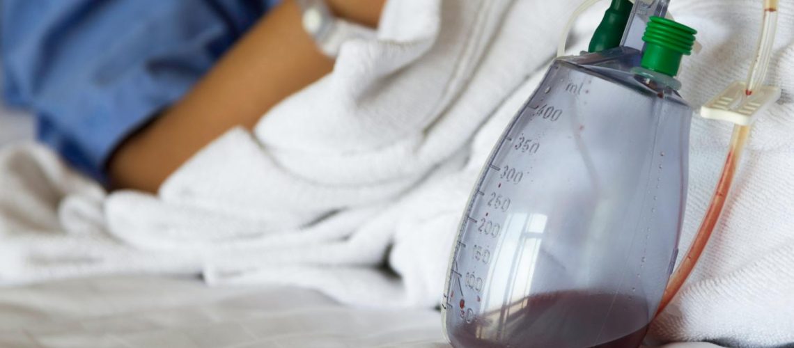 Pourquoi pose-t-on un drain de Redon après une opération ?