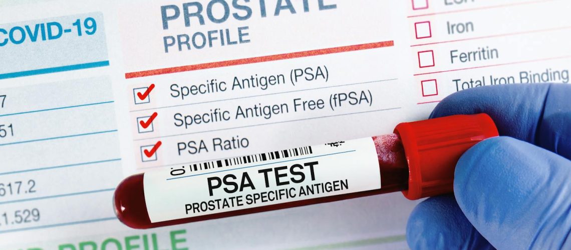 Prostate : pourquoi faut-il surveiller son taux de PSA ?